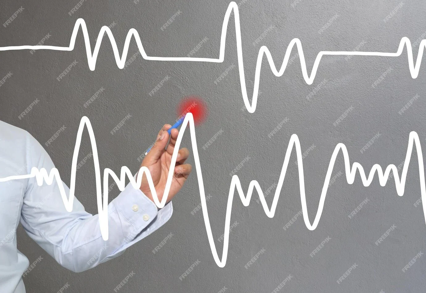 low atrial rhythm causes