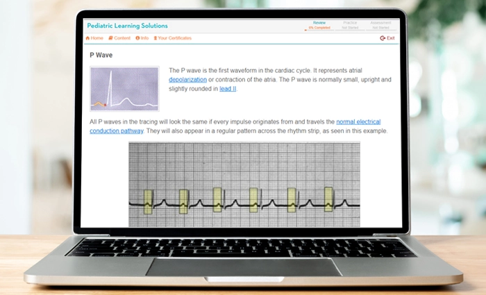 arrhythmia recognition