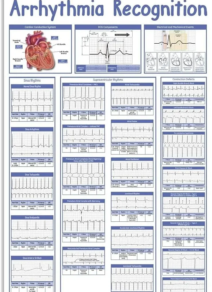 arrhythmia recognition