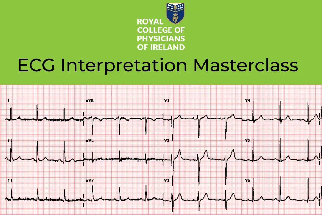 ECG